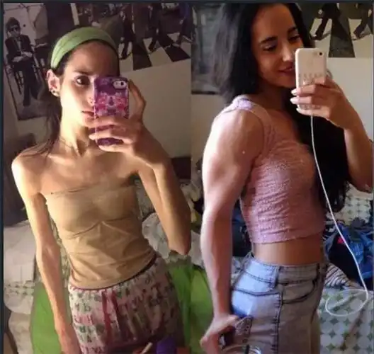 瘦子(瘦子菌真的能减肥吗)