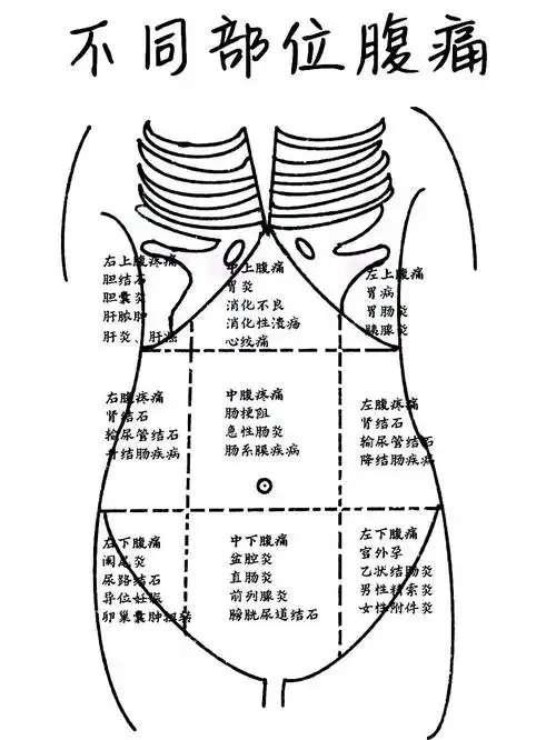 腹痛"九分区"明明白白