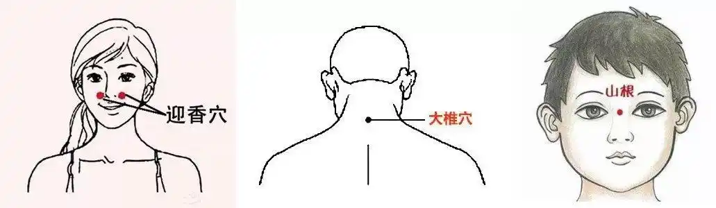 但相对来说,贴在  后颈大椎穴 更不影响面容, 对于 爱美的妹纸 来说