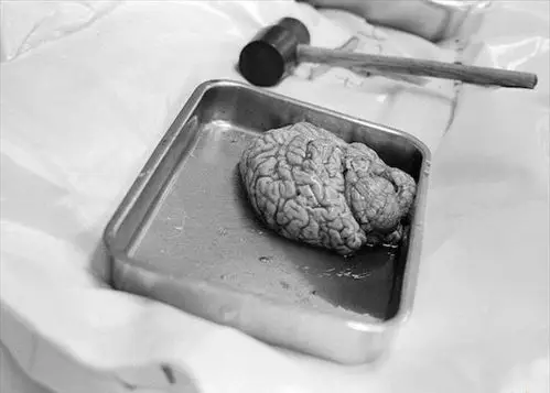 摄影师真实记录法医验尸全程[组图]