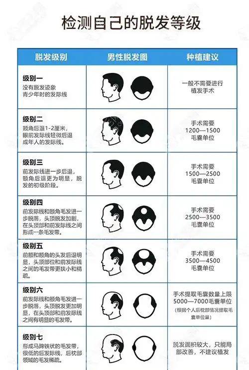 脱发等级示意图