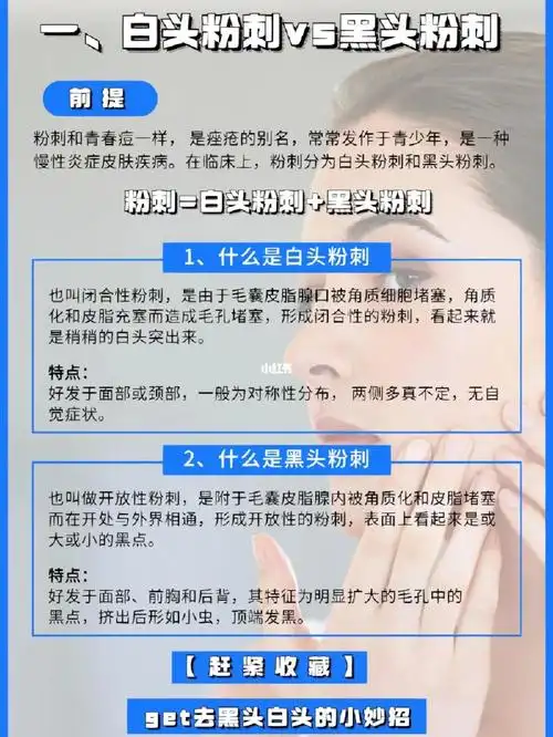 白头粉刺和黑头粉刺怎么办小妙招来咯