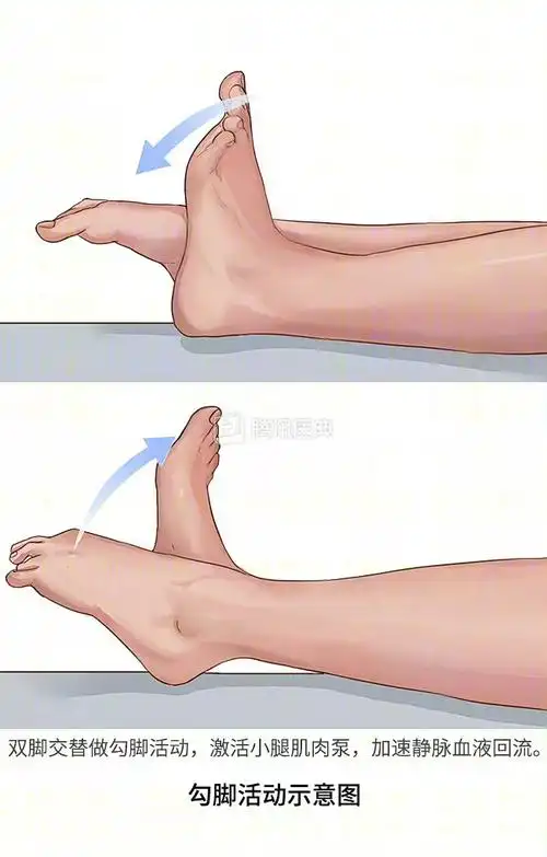 东莞3人返工时患经济舱综合征身亡