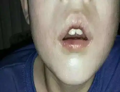 宝宝睡觉张着小嘴,宝妈看着可爱,没想到几年后后悔不已