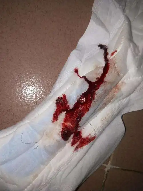 不正常月经颜色正常图 月经快结束颜色对照图-图片大观-奇异网