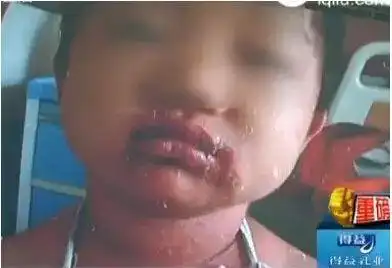 5个男孩小鸡鸡被割伤进了急诊……其中这个"凶器"