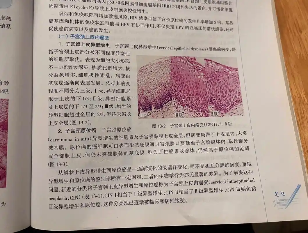 书本知识科普——宫颈原位癌 这个是我在我弟弟的医学课本上看到的