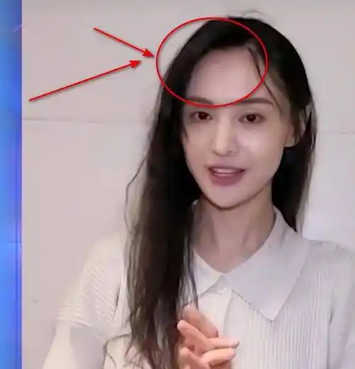 33岁郑爽最新近照曝光!医美失败脸全垮了,暴瘦似纸片人显憔悴