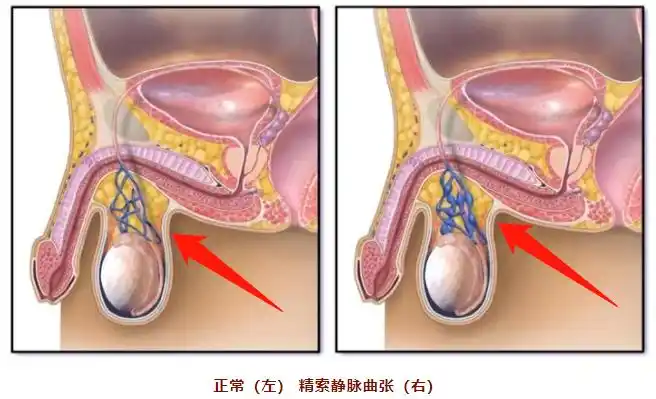 睾丸是两个微扁的椭圆体,分别悬垂于阴囊内的两侧.