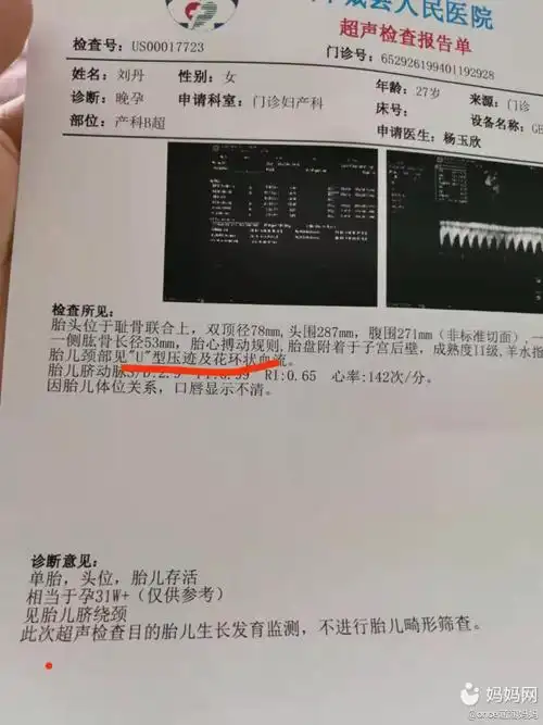 这个胎儿颈部见u型压迹及花环状血流,这种是啥意思,,有会看的嘛.