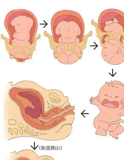 第三产程:胎盘娩出第二产程:胎头下降第