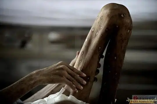 小熊维泥的相册恐怖的艾滋病晚期