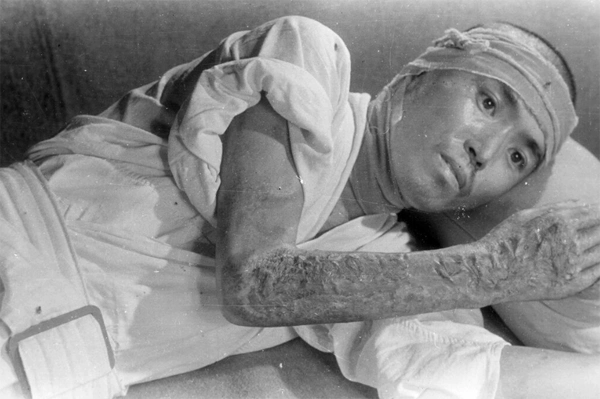 广岛核爆75周年,蘑菇云下的人间惨剧