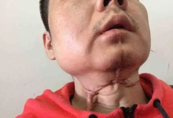 那些把槟榔当零食吃的人后来都怎样了多数人或许不清楚