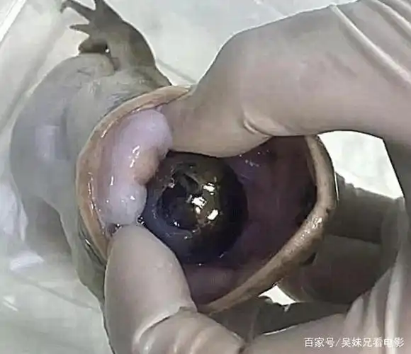 青蛙肚子肿了两颗球,以为吃太饱,看到抠出来的东西,吓到了