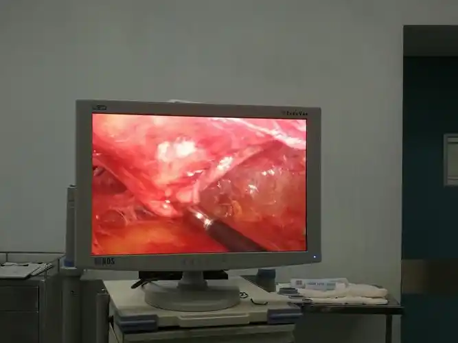 乳腺囊肿的腔镜微创手术 - 好大夫在线