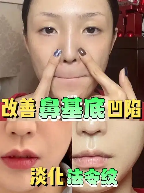 三个动作淡化法令纹改善鼻基底凹陷