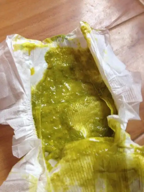 母乳喂养拉这样的粑粑正常吗有图