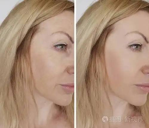 面部女孩皱纹前和后化妆程序照片-正版商用图片0psg3e-摄图新视界