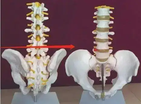 脊椎的精确定位及触诊技巧|腰椎|曲度|胸椎|椎体_网易订阅