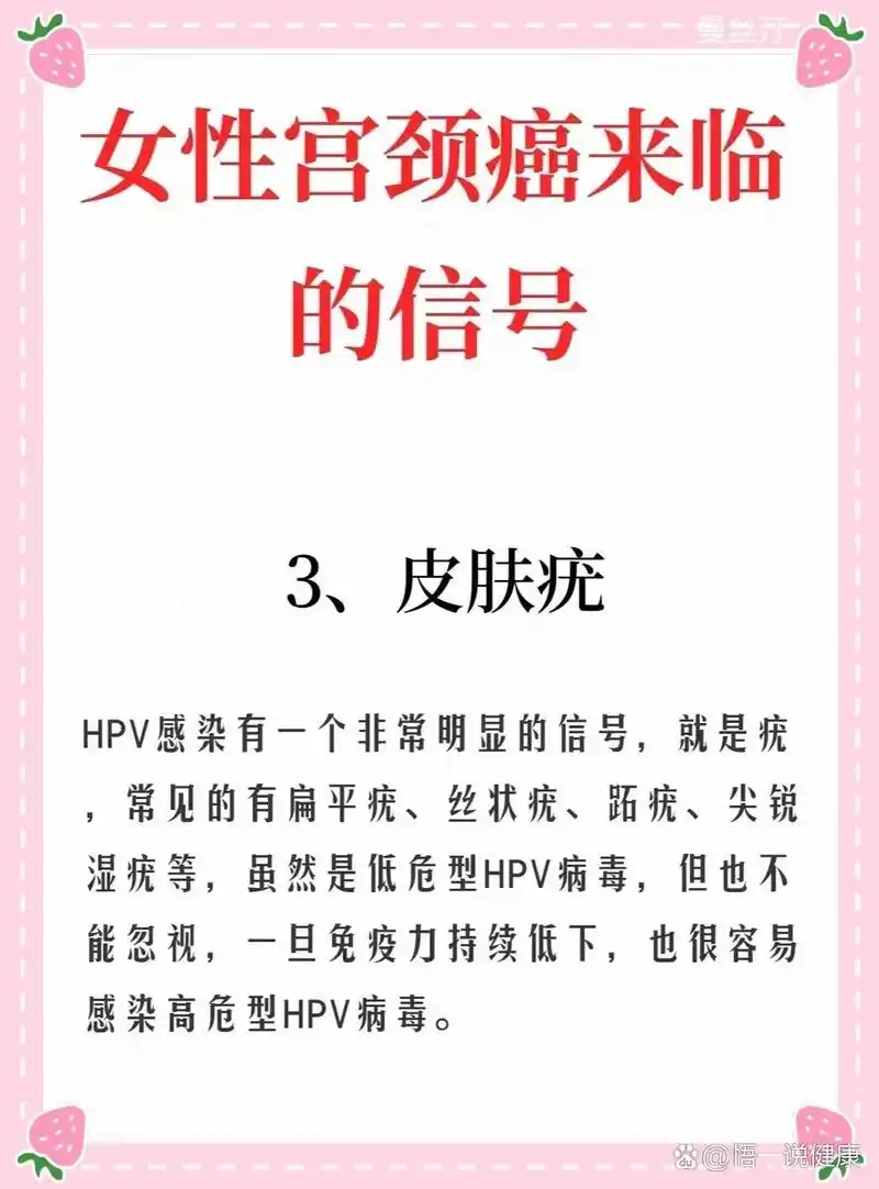 宫颈癌来临的信号希望可以帮到你7815 然而,了解这些可能的前兆有