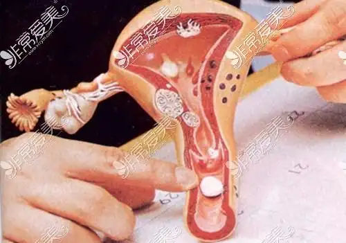 女性产道构造图