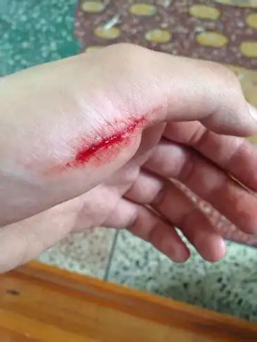 手被割伤的幽默说说(合计101段)