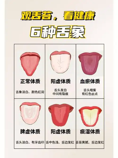 颜色红润若平时有食欲差,生病,唾液分泌少,也会影响舌苔正常颜色