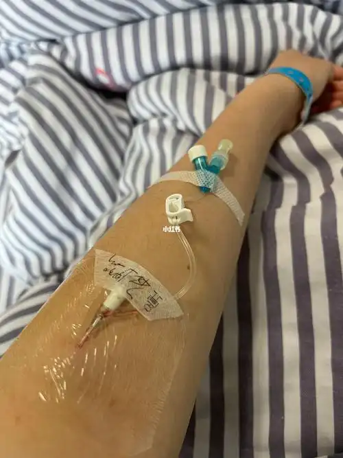 痔疮手术第二天