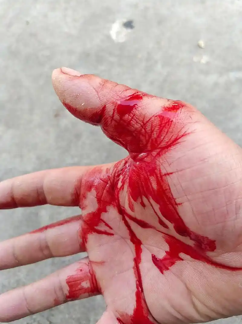 男人嘛,就是这样,流血不流泪.,当自 - 抖音