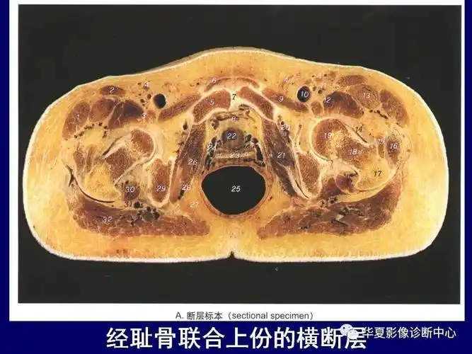 最全的下肢mri解剖