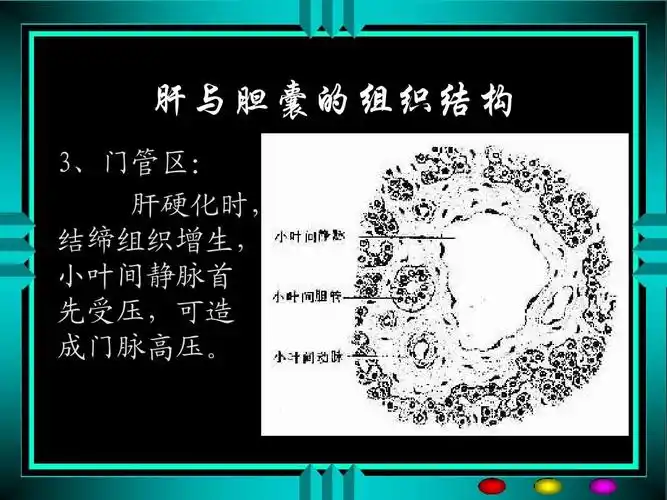 肝与胆囊的组织结构 3,门管区: 肝硬化时, 结缔组织增生, 小叶间静脉