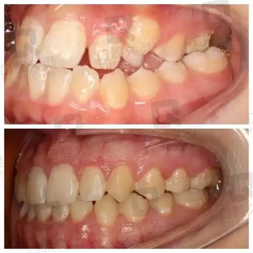 上海丰松悦康口腔牙齿矫正好不好?