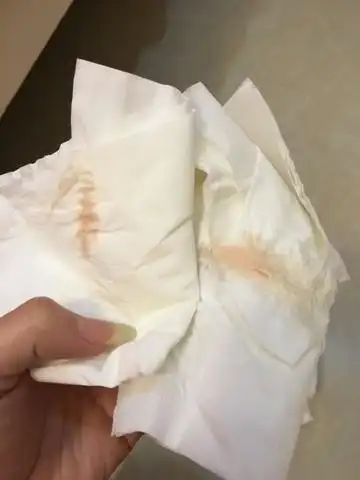 孕晚期出血,粉红色