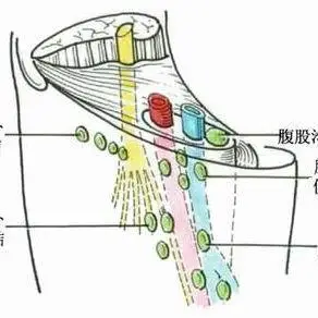腹股沟淋巴结的病因 中医传统针灸治疗