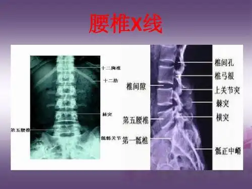 脊柱基础解剖学ppt