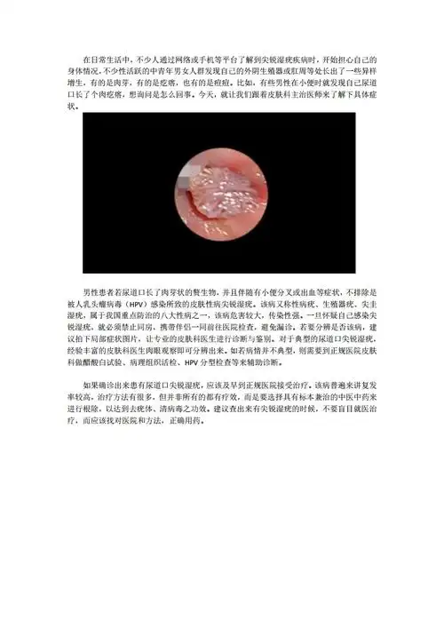 尿道口长了个肉疙瘩怎么回事docx