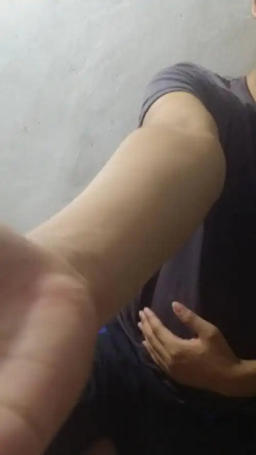 各位大哥大姐,我手臂肘外翻严重吗?大概多少度?当兵体检能过