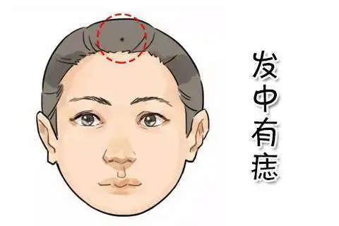 不容易被人看到的痣通常都是好痣,因此头发中有痣是不可多得的吉痣