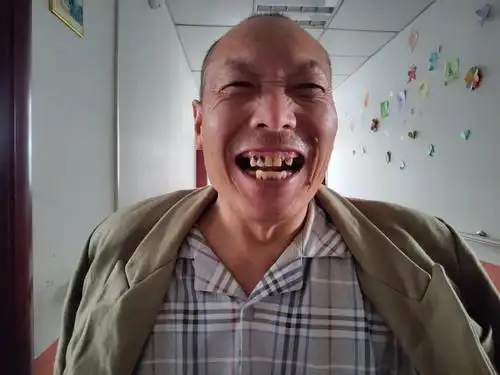 【颐和随记】口常开,笑出健康的牙齿来——第31个全国晒牙日_老人