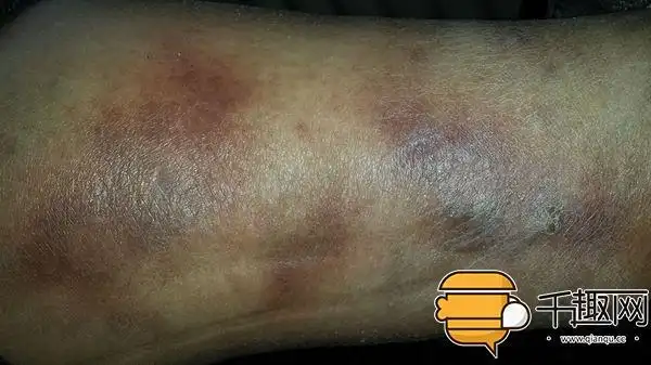 老人被判定死亡4小时后,竟开棺材复活!诈尸了?