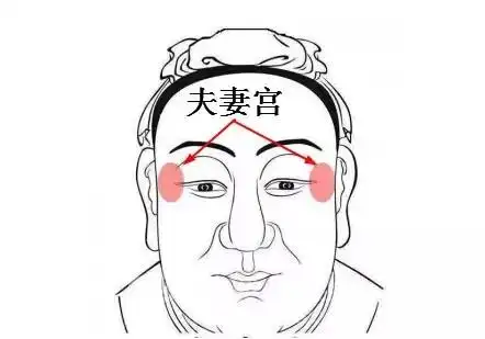 魅力提升:自体脂肪丰太阳穴太阳穴又称夫妻宫,若太阳穴饱满,则夫妻