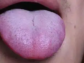 不花一分钱,在家就能体检!心,肾,血管,骨头…10个部位都齐了