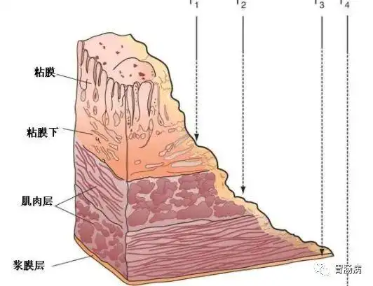它一般位于人体胸骨剑突的下方,肚脐上方,略微偏左,上经贲门连接食管