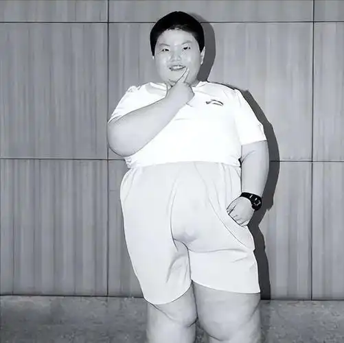 江西14岁男孩体重300斤,过度肥胖英年早逝,临终愿望令人唏嘘