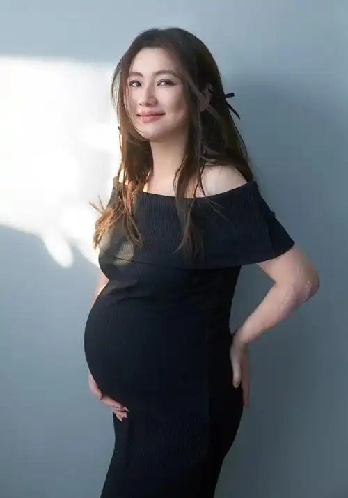 41岁selina挺孕肚拍写真,烧伤痕迹明显惹人疼,曾被曝去父留子