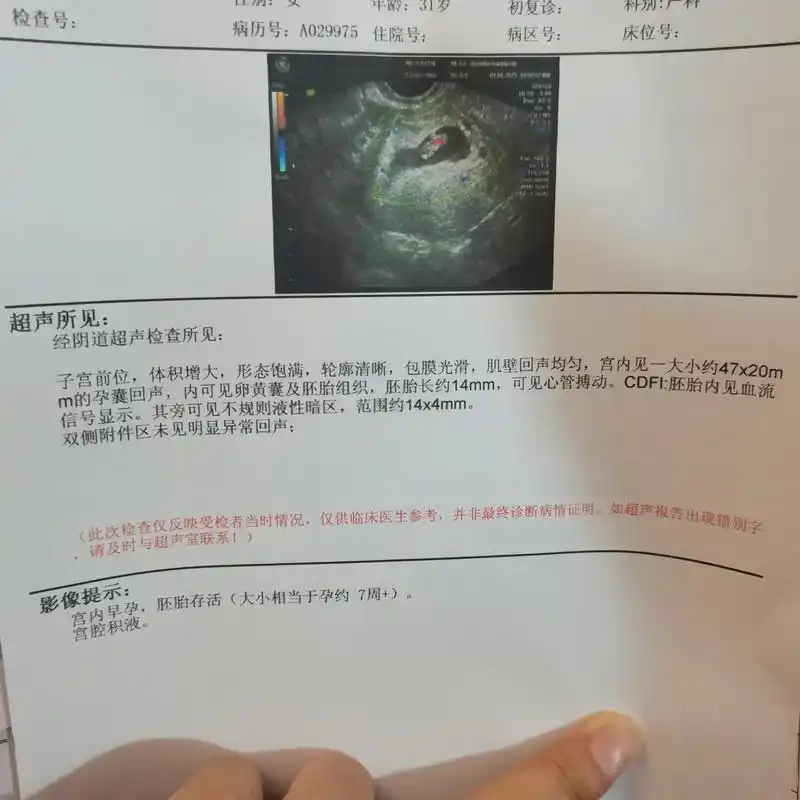 帮忙看看这个孕囊是长的还是圆形的猜男女