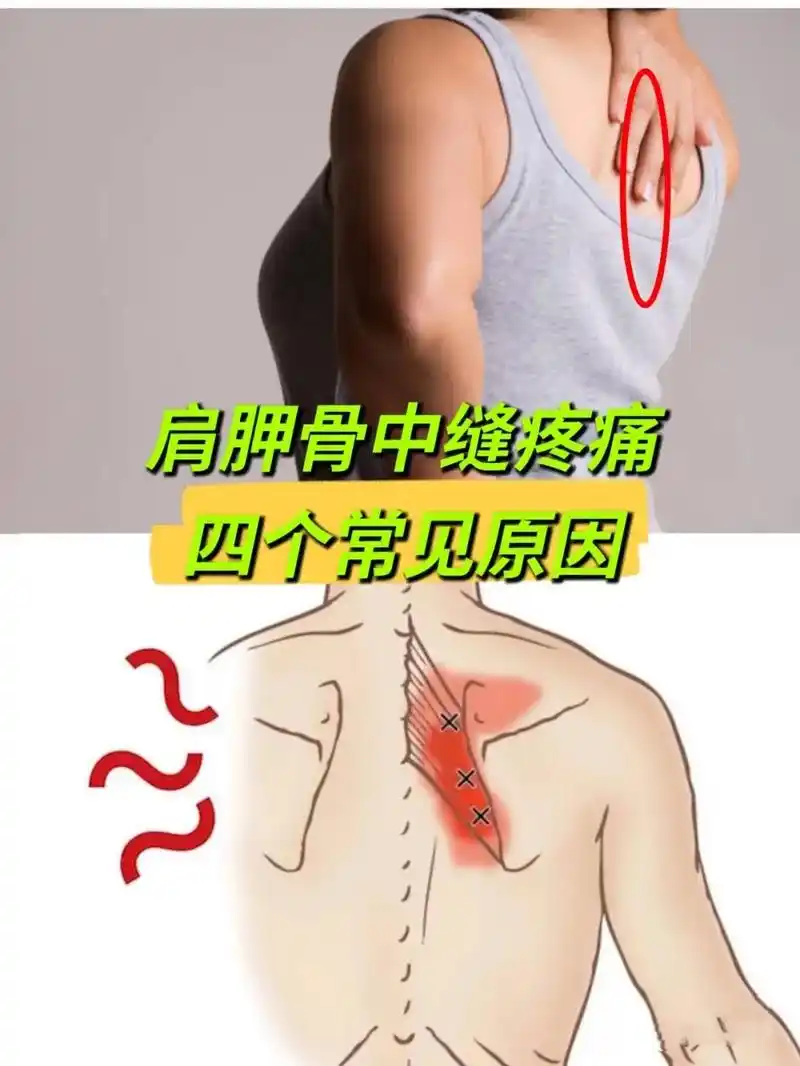 肩胛骨内侧疼痛的四个原因.单侧肩胛骨内侧 中间痛非常常见,  - 抖音