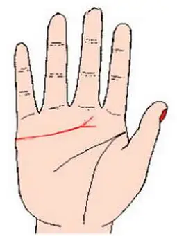 1,感情线末端出现分叉:末端双侧叉