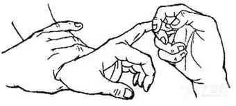 8,罗索里莫(rossolimo)征 二,浅反射 1,腹壁反射(t7-12) 2,提睾反射